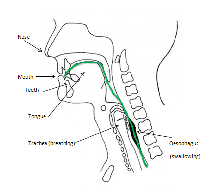 Dysphagia/Swallowing Difficulties - Get Hackney Talking